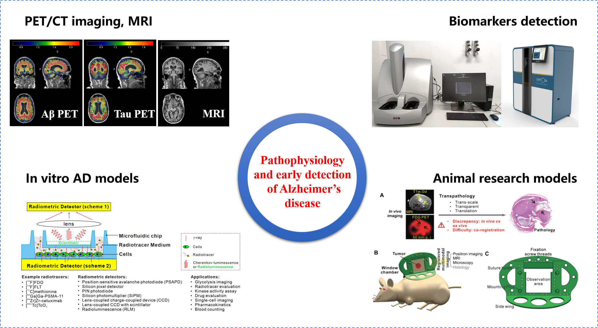 Pathophysiology characterization and early detection of Alzheimer's disease